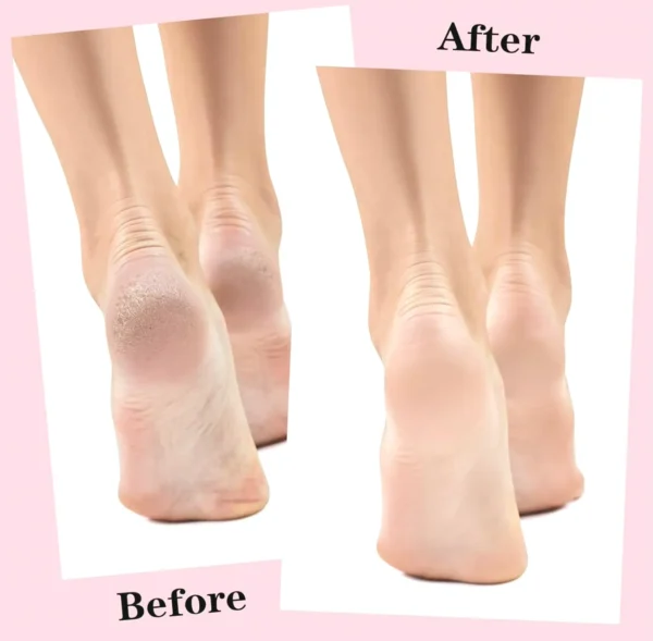 Two Pairs Moisturizing Footwear for Women