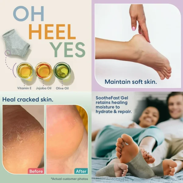 Moisturizing Heel Socks for Dry Heels - 2 Sets